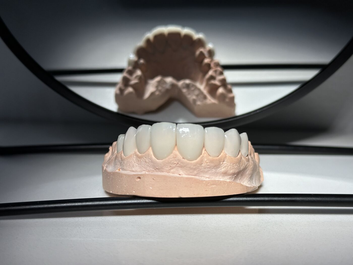 Modelo de diseño de sonrisa en cerámica